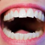 Profilaktyka czyli jak odpowiednio dbać o swoje zęby